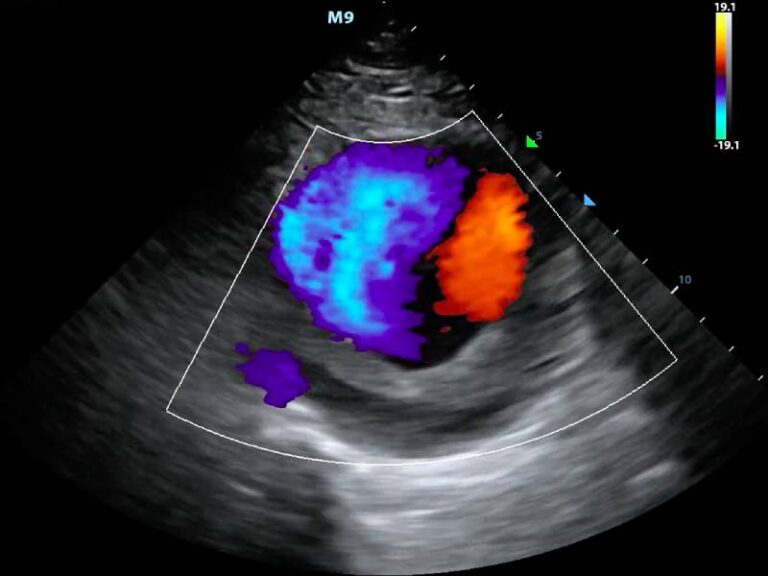 colour-doppler-megavision-diagnostics-centers